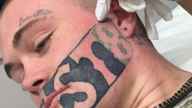 Does Within Your Own Tattoo Removal Really Projects?