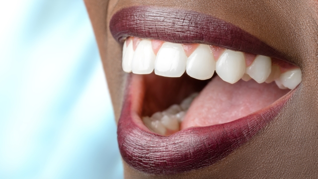 Unlock Your Brightest Smile: The Ultimate Guide to Teeth Whitening