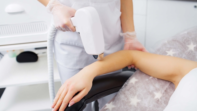 Unveiling the Smooth: The Ultimate Guide to Laser Hair Removal